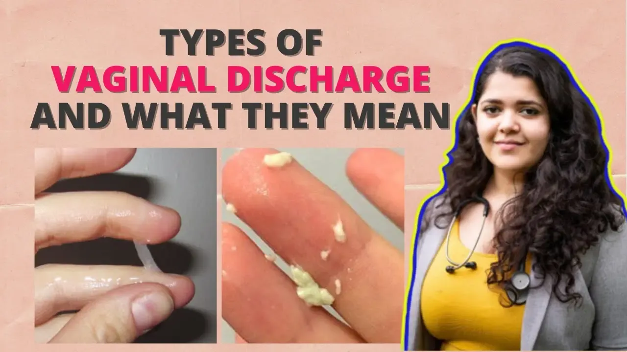 Types Of Vaginal Discharge
