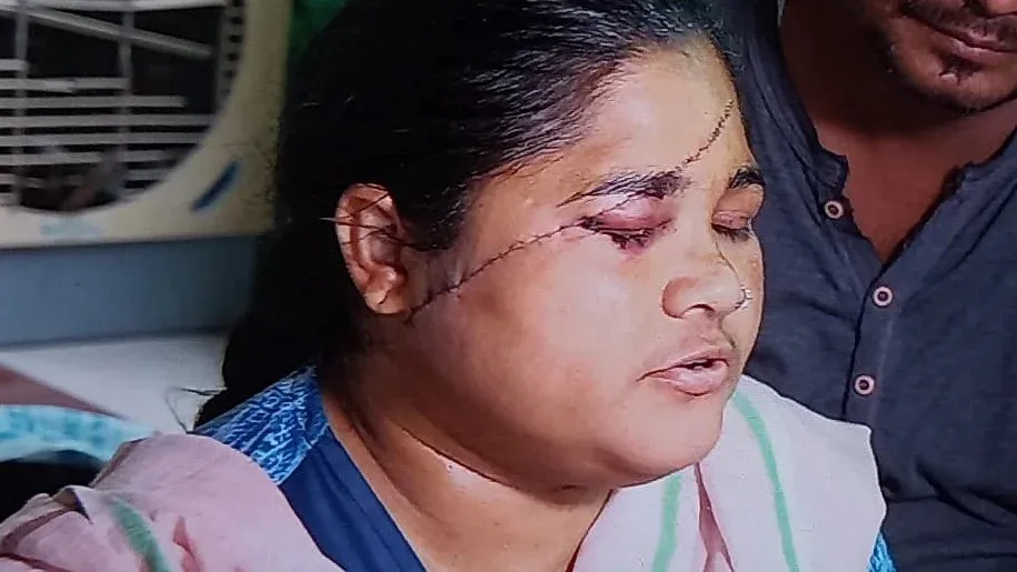 38-Year-Old Woman Beaten With Blade